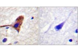 Immunohistochemistry analysis of paraffin-embedded human brain tissue, using mTOR (Ab-2481) Antibody. (MTOR Antikörper  (AA 2447-2496))