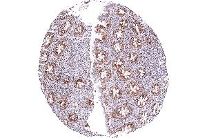 Appendix mucosa showing a strong granular cytoplasmic SDHA positivity of all epithelial cells while staining is weak to moderate in lymphocytes (Rekombinanter SDHA Antikörper  (N-Term))