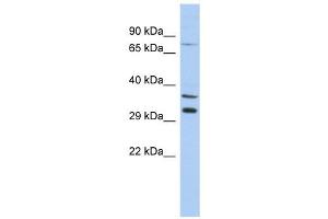 TSGA13 antibody used at 1 ug/ml to detect target protein. (TSGA13 Antikörper  (Middle Region))