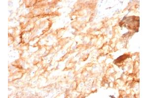 Formalin-fixed, paraffin-embedded human Kidney stained with CD10 Mouse Monoclonal Antibody (MME/2590). (MME Antikörper  (AA 297-483))