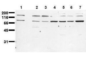 Western Blotting (WB) image for anti-Insulin Receptor (INSR) (Beta Chain) antibody (ABIN126820) (Insulin Receptor Antikörper  (Beta Chain))