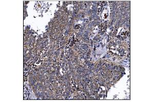 IHC analysis of DLGAP1 using anti-DLGAP1 antibody (ABIN7600257).