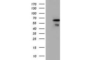 Western Blotting (WB) image for anti-Numb Homolog (NUMB) antibody (ABIN1499877) (NUMB Antikörper)