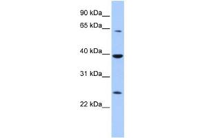 WB Suggested Anti-CIAO1 Antibody Titration:  0. (CIAO1 Antikörper  (Middle Region))