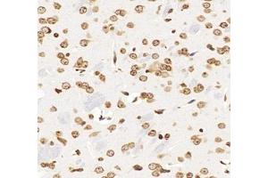 Immunohistochemistry analysis of paraffin-embedded mouse brain using,GSTT1 (ABIN7074091) at dilution of 1: 2000 (GSTT1 Antikörper)