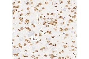 Immunohistochemistry analysis of paraffin-embedded mouse brain using,GSTT1 (ABIN7074091) at dilution of 1: 2000