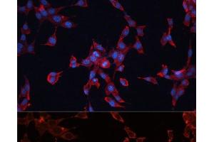 Immunofluorescence analysis of NIH-3T3 cells using GPC3 Polyclonal Antibody at dilution of 1:100 (40x lens). (Glypican 3 Antikörper)