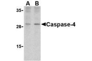 Western blot analysis of caspase-4 in human spleen cells with AP30198PU-N caspase-4 antibody at (A) 1 and (B) 2 μg/ml. (Caspase 4 Antikörper  (Intermediate Domain))