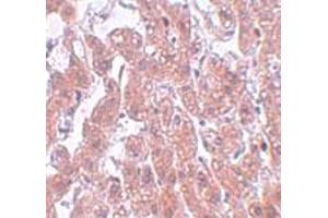 Immunohistochemical staining of human brain tissue with 5 ug/mL FAM59A polyclonal antibody . (FAM59A Antikörper  (C-Term))