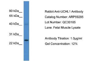 WB Suggested Anti-UCHL1  Antibody Titration: 0. (UCHL1 Antikörper  (C-Term))