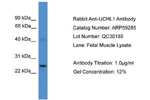 WB Suggested Anti-UCHL1  Antibody Titration: 0.