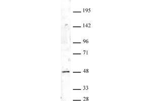 HOXA9 antibody (pAb) tested by Western blot. (HOXA9 Antikörper  (N-Term))