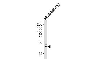 Western blot analysis of lysate from MDA-MB-453 cell line, using IL5RA Antibody (N-term) (ABIN651428 and ABIN2840234).