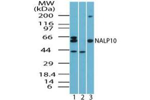 Image no. 1 for anti-NLR Family, Pyrin Domain Containing 10 (NLRP10) (AA 493-509) antibody (ABIN960280)
