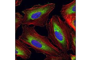 Image no. 1 for anti-Eukaryotic Translation Elongation Factor 1 alpha 1 (EEF1A1) antibody (ABIN329131) (eEF1A1 Antikörper)