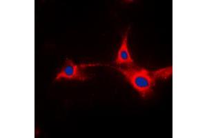 Immunofluorescent analysis of PFKFB2 staining in HepG2 cells. (PFKFB2 Antikörper  (N-Term))
