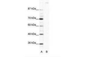 Image no. 1 for anti-Zinc Finger Protein GLI1 (GLI1) (AA 1007-1056) antibody (ABIN202974) (GLI1 Antikörper  (AA 1007-1056))