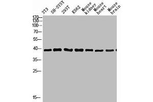Western Blot analysis of various cells using Antibody diluted at 1:1000. (KIR3DL1 Antikörper  (N-Term))