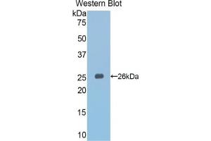 Detection of Recombinant Slit3, Mouse using Polyclonal Antibody to Slit Homolog 3 (Slit3) (SLIT3 Antikörper  (AA 1348-1517))