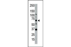 Image no. 1 for anti-SUMO1/sentrin Specific Peptidase 1 (SENP1) (N-Term) antibody (ABIN356749) (SENP1 Antikörper  (N-Term))