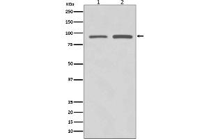 Western blot analysis of SUZ12 expression in (1) HeLa cell lysate, (2) SW480 cell lysate.