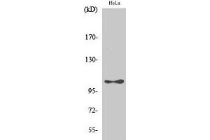 Western Blot analysis of Hela cells with Phospho-eEF2K (Ser366) Polyclonal Antibody at dilution of 1:1000 (EEF2K Antikörper  (pSer366))