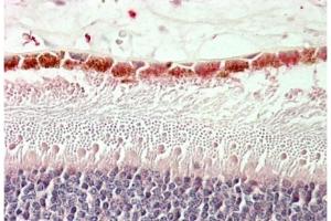 Staining of paraffin embedded Human Retina using RDH5 antibody at 5 µg/ml. (RDH5 Antikörper  (Internal Region))