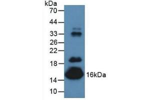 Detection of PALB in Mouse Serum using Polyclonal Antibody to Prealbumin (PALB) (TTR Antikörper  (AA 21-147))