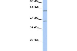 WB Suggested Anti-NUP43 Antibody Titration: 0. (NUP43 Antikörper  (Middle Region))