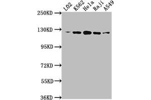 Western Blot Positive WB detected in: L02 whole cell lysate, K562 whole cell lysate, Hela whole cell lysate, Raji whole cell lysate, A549 whole cell lysate All lanes: ACLY antibody at 1:1500 Secondary Goat polyclonal to rabbit IgG at 1/50000 dilution Predicted band size: 121, 120, 92 kDa Observed band size: 120 kDa (Rekombinanter ACLY Antikörper)