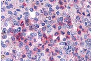 Immunohistochemistry (Formalin-fixed Paraffin-embedded Sections) (IHC (fp)) image for anti-serum/glucocorticoid Regulated Kinase Family, Member 3 (SGK3) (AA 107-156) antibody (ABIN6745757)