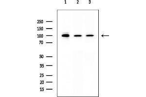 Western blot analysis of lysates from various samples, using MLL5 Mouse Monoclonal Antibody at 1/1000 dilution.