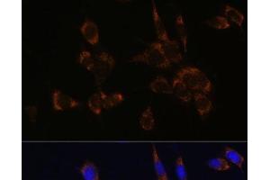 Immunofluorescence analysis of NIH/3T3 cells using Perforin Polyclonal Antibody at dilution of 1:100. (Perforin 1 Antikörper)