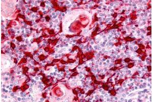 Human Thymus (formalin-fixed, paraffin-embedded) stained with USP4 antibody ABIN213586 at 5 ug/ml followed by biotinylated goat anti-rabbit IgG secondary antibody ABIN481713, alkaline phosphatase-streptavidin and chromogen. (USP4 Antikörper  (Internal Region))
