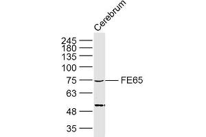 Lane 1: Mouse cerebrum lysates probed with FE65 Polyclonal Antibody, Unconjugated (bs-0110R) at 1:300 overnight at 4˚C. (FE65 Antikörper  (AA 201-300))