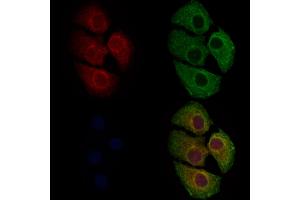 ABIN6262169 and ABIN6279682 staining Hela cells by IF/ICC. (HCN3 Antikörper  (C-Term))