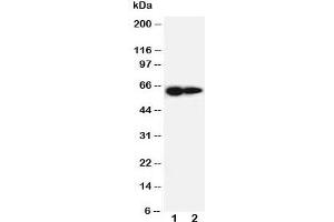 Western blot testing of IL-2 Receptor antibody and Lane 1:  PANC cell lysate ;  2: HeLa cell lysate. (IL2 Receptor beta Antikörper  (AA 117-135))