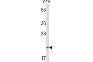 Western Blotting (WB) image for anti-TRAF-Interacting Protein with Forkhead-Associated Domain (TIFA) antibody (ABIN3004238) (TIFA Antikörper)