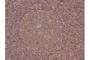 IHC image of ABIN7139747 diluted at 1:100 and staining in paraffin-embedded human tonsil tissue performed on a Leica BondTM system. (CELSR1 Antikörper  (AA 345-363))