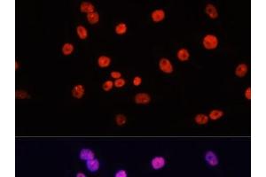 Immunofluorescence analysis of HeLa cells using MYCT1 Polyclonal Antibody at dilution of 1:100. (Myc Target 1 Antikörper)
