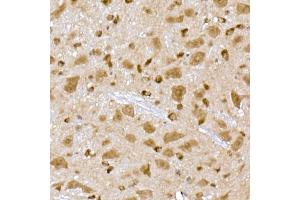 Immunohistochemistry of paraffin-embedded mouse brain using PPCS Rabbit mAb (ABIN7269360) at dilution of 1:25 (40x lens). (PPCS Antikörper)