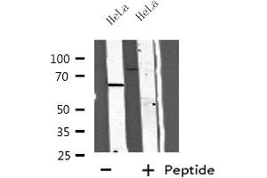 Western blot analysis of extracts from HeLa cells, using CC14A antibody. (CDC14A Antikörper  (Internal Region))
