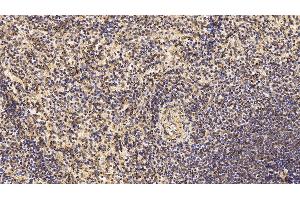 Immunohistochemistry (IHC) image for anti-CD3 epsilon (CD3E) (AA 28-185) antibody (ABIN7428527)