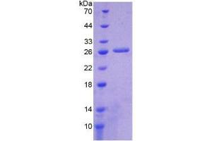 SDS-PAGE analysis of Human ICA1 Protein. (ICA1 Protein)