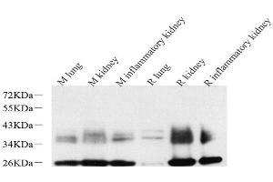 Western Blot analysis of various samples using AQP1 Polyclonal Antibody at dilution of 1:2000. (Aquaporin 1 Antikörper)