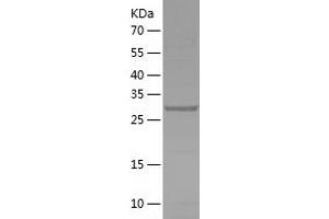 Western Blotting (WB) image for Phosphatase, Orphan 1 (PHOSPHO1) (AA 1-267) protein (His tag) (ABIN7124394)