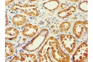 Immunohistochemistry of paraffin-embedded human kidney tissue using ABIN7143588 at dilution of 1:100 (AKR7A3 Antikörper  (AA 1-331))