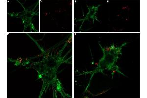 Live cell imaging of ω-Conotoxin MVIIC-Biotin in differentiated  cells. (Conotoxin MVIIC omega peptide (Biotin))