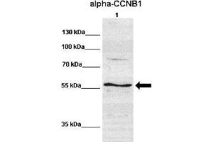 WB Suggested Anti-CCNB1 Antibody  Positive Control: Lane 1:641 µg human NT2 cell line Primary Antibody Dilution: 1:000Secondary Antibody: IRDye 800 CW goat anti-rabbit from Li-COR BioscienceSecondry  Antibody Dilution: 1:00,000Submitted by: Dr.