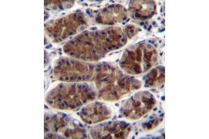 CTGF Antibody (Center) (ABIN392205 and ABIN2841905) immunohistochemistry analysis in formalin fixed and paraffin embedded human stomach tissue followed by peroxidase conjugation of the secondary antibody and DAB staining. (CTGF Antikörper  (AA 134-159))